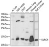 Western blot analysis of extracts of various cell lines, using KLRC4 antibody (15-739) at 1:1000 dilution.<br/>Secondary antibody: HRP Goat Anti-Rabbit IgG (H+L) at 1:10000 dilution.<br/>Lysates/proteins: 25ug per lane.<br/>Blocking buffer: 3% nonfat dry milk in TBST.<br/>Detection: ECL Basic Kit.<br/>Exposure time: 30s.