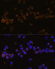 Immunofluorescence analysis of Jurkat cells using KLRC4 Polyclonal Antibody (15-739) at dilution of 1:100 (40x lens) . Blue: DAPI for nuclear staining.