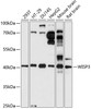 Western blot analysis of extracts of various cell lines, using WISP3 antibody (15-742) at 1:1000 dilution.<br/>Secondary antibody: HRP Goat Anti-Rabbit IgG (H+L) at 1:10000 dilution.<br/>Lysates/proteins: 25ug per lane.<br/>Blocking buffer: 3% nonfat dry milk in TBST.<br/>Detection: ECL Basic Kit.<br/>Exposure time: 30s.