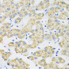 Immunohistochemistry of paraffin-embedded human liver using SLC16A4 antibody (15-745) at dilution of 1:100 (40x lens) .