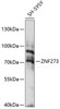 Western blot analysis of extracts of SH-SY5Y cells, using ZNF273 antibody (15-760) at 1:1000 dilution.<br/>Secondary antibody: HRP Goat Anti-Rabbit IgG (H+L) at 1:10000 dilution.<br/>Lysates/proteins: 25ug per lane.<br/>Blocking buffer: 3% nonfat dry milk in TBST.<br/>Detection: ECL Basic Kit.<br/>Exposure time: 15s.