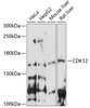 Western blot analysis of extracts of various cell lines, using CDK12 antibody (15-778) at 1:1000 dilution.<br/>Secondary antibody: HRP Goat Anti-Rabbit IgG (H+L) at 1:10000 dilution.<br/>Lysates/proteins: 25ug per lane.<br/>Blocking buffer: 3% nonfat dry milk in TBST.<br/>Detection: ECL Enhanced Kit.<br/>Exposure time: 90s.