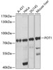 Western blot analysis of extracts of various cell lines, using POT1 antibody (15-787) at 1:1000 dilution.<br/>Secondary antibody: HRP Goat Anti-Rabbit IgG (H+L) at 1:10000 dilution.<br/>Lysates/proteins: 25ug per lane.<br/>Blocking buffer: 3% nonfat dry milk in TBST.<br/>Detection: ECL Basic Kit.<br/>Exposure time: 30s.