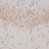 Immunohistochemistry of paraffin-embedded rat brain using TMX1 antibody (15-795) at dilution of 1:100 (40x lens) .