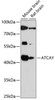 Western blot analysis of extracts of various cell lines, using ATCAY antibody (15-800) at 1:1000 dilution.<br/>Secondary antibody: HRP Goat Anti-Rabbit IgG (H+L) at 1:10000 dilution.<br/>Lysates/proteins: 25ug per lane.<br/>Blocking buffer: 3% nonfat dry milk in TBST.<br/>Detection: ECL Basic Kit.<br/>Exposure time: 90s.