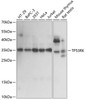 Western blot analysis of extracts of various cell lines, using TP53RK antibody (15-802) at 1:1000 dilution.<br/>Secondary antibody: HRP Goat Anti-Rabbit IgG (H+L) at 1:10000 dilution.<br/>Lysates/proteins: 25ug per lane.<br/>Blocking buffer: 3% nonfat dry milk in TBST.<br/>Detection: ECL Basic Kit.<br/>Exposure time: 5s.