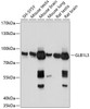 Western blot analysis of extracts of various cell lines, using GLB1L3 antibody (15-803) at 1:1000 dilution.<br/>Secondary antibody: HRP Goat Anti-Rabbit IgG (H+L) at 1:10000 dilution.<br/>Lysates/proteins: 25ug per lane.<br/>Blocking buffer: 3% nonfat dry milk in TBST.<br/>Detection: ECL Basic Kit.<br/>Exposure time: 1s.