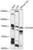 Western blot analysis of extracts of various cell lines, using SLC5A9 antibody (15-813) at 1:1000 dilution.<br/>Secondary antibody: HRP Goat Anti-Rabbit IgG (H+L) at 1:10000 dilution.<br/>Lysates/proteins: 25ug per lane.<br/>Blocking buffer: 3% nonfat dry milk in TBST.<br/>Detection: ECL Basic Kit.<br/>Exposure time: 30s.