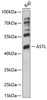 Western blot analysis of extracts of Raji cells, using ASTL antibody (15-819) at 1:1000 dilution.<br/>Secondary antibody: HRP Goat Anti-Rabbit IgG (H+L) at 1:10000 dilution.<br/>Lysates/proteins: 25ug per lane.<br/>Blocking buffer: 3% nonfat dry milk in TBST.<br/>Detection: ECL Basic Kit.<br/>Exposure time: 60s.