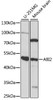 Western blot analysis of extracts of various cell lines, using ABI2 antibody (15-821) at 1:1000 dilution.<br/>Secondary antibody: HRP Goat Anti-Rabbit IgG (H+L) at 1:10000 dilution.<br/>Lysates/proteins: 25ug per lane.<br/>Blocking buffer: 3% nonfat dry milk in TBST.<br/>Detection: ECL Basic Kit.<br/>Exposure time: 90s.