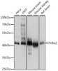 Western blot analysis of extracts of various cell lines, using Pdha2 antibody (15-822) at 1:1000 dilution.<br/>Secondary antibody: HRP Goat Anti-Rabbit IgG (H+L) at 1:10000 dilution.<br/>Lysates/proteins: 25ug per lane.<br/>Blocking buffer: 3% nonfat dry milk in TBST.<br/>Detection: ECL Basic Kit.<br/>Exposure time: 1s.