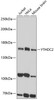 Western blot analysis of extracts of various cell lines, using YTHDC2 antibody (15-826) at 1:1000 dilution.<br/>Secondary antibody: HRP Goat Anti-Rabbit IgG (H+L) at 1:10000 dilution.<br/>Lysates/proteins: 25ug per lane.<br/>Blocking buffer: 3% nonfat dry milk in TBST.<br/>Detection: ECL Basic Kit.<br/>Exposure time: 60s.