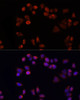 Immunofluorescence analysis of HeLa cells using SLC25A4 antibody (15-839) at dilution of 1:100 (40x lens) . Blue: DAPI for nuclear staining.