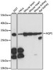 Western blot analysis of extracts of various cell lines, using AQP1 antibody (15-840) at 1:1000 dilution.<br/>Secondary antibody: HRP Goat Anti-Rabbit IgG (H+L) at 1:10000 dilution.<br/>Lysates/proteins: 25ug per lane.<br/>Blocking buffer: 3% nonfat dry milk in TBST.<br/>Detection: ECL Basic Kit.<br/>Exposure time: 1s.