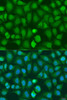 Immunofluorescence analysis of U2OS cells using CHD1 antibody (15-841) at dilution of 1:100. Blue: DAPI for nuclear staining.