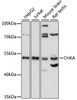 Western blot analysis of extracts of various cell lines, using CHKA antibody (15-842) at 1:1000 dilution.<br/>Secondary antibody: HRP Goat Anti-Rabbit IgG (H+L) at 1:10000 dilution.<br/>Lysates/proteins: 25ug per lane.<br/>Blocking buffer: 3% nonfat dry milk in TBST.<br/>Detection: ECL Basic Kit.<br/>Exposure time: 30s.