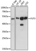 Western blot analysis of extracts of various cell lines, using FUT3 antibody (15-853) at 1:1000 dilution.<br/>Secondary antibody: HRP Goat Anti-Rabbit IgG (H+L) at 1:10000 dilution.<br/>Lysates/proteins: 25ug per lane.<br/>Blocking buffer: 3% nonfat dry milk in TBST.<br/>Detection: ECL Basic Kit.<br/>Exposure time: 90s.