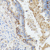 Immunohistochemistry of paraffin-embedded Rat lung using KRT14 antibody (15-857) at dilution of 1:100 (40x lens) .
