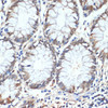 Immunohistochemistry of paraffin-embedded human colon using HSPA1A antibody (15-858) at dilution of 1:100 (40x lens) .