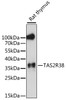 Western blot analysis of extracts of rat thymus, using TAS2R38 antibody (15-868) at 1:1000 dilution.<br/>Secondary antibody: HRP Goat Anti-Rabbit IgG (H+L) at 1:10000 dilution.<br/>Lysates/proteins: 25ug per lane.<br/>Blocking buffer: 3% nonfat dry milk in TBST.<br/>Detection: ECL Enhanced Kit.<br/>Exposure time: 90s.