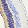 Immunohistochemistry of paraffin-embedded mouse retina using RHO antibody (15-872) at dilution of 1:200 (40x lens) .