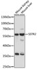 Western blot analysis of extracts of various cell lines, using SSTR2 antibody (15-879) at 1:1000 dilution.<br/>Secondary antibody: HRP Goat Anti-Rabbit IgG (H+L) at 1:10000 dilution.<br/>Lysates/proteins: 25ug per lane.<br/>Blocking buffer: 3% nonfat dry milk in TBST.<br/>Detection: ECL Enhanced Kit.<br/>Exposure time: 30s.