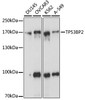 Western blot analysis of extracts of various cell lines, using TP53BP2 antibody (15-882) at 1:1000 dilution.<br/>Secondary antibody: HRP Goat Anti-Rabbit IgG (H+L) at 1:10000 dilution.<br/>Lysates/proteins: 25ug per lane.<br/>Blocking buffer: 3% nonfat dry milk in TBST.<br/>Detection: ECL Basic Kit.<br/>Exposure time: 1s.