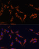 Immunofluorescence analysis of C6 cells using KSR1 Polyclonal Antibody (15-886) at dilution of 1:100 (40x lens) . Blue: DAPI for nuclear staining.