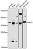 Western blot analysis of extracts of various cell lines, using HEY2 antibody (15-901) at 1:1000 dilution.<br/>Secondary antibody: HRP Goat Anti-Rabbit IgG (H+L) at 1:10000 dilution.<br/>Lysates/proteins: 25ug per lane.<br/>Blocking buffer: 3% nonfat dry milk in TBST.<br/>Detection: ECL Basic Kit.<br/>Exposure time: 60s.