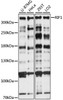 Western blot analysis of extracts of various cell lines, using RIF1 antibody (15-911) at 1:1000 dilution.<br/>Secondary antibody: HRP Goat Anti-Rabbit IgG (H+L) at 1:10000 dilution.<br/>Lysates/proteins: 25ug per lane.<br/>Blocking buffer: 3% nonfat dry milk in TBST.<br/>Detection: ECL Basic Kit.<br/>Exposure time: 30s.