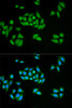 Immunofluorescence analysis of HeLa cells using UPF1 antibody (15-930) . Blue: DAPI for nuclear staining.