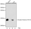 Western blot analysis of extracts of various cell lines, using Acetyl-Histone H4-K5 antibody (15-941) at 1:1000 dilution. HeLa cells were treated by TSA (1uM) for 18 hours. C6 cells were treated by TSA (1uM) for 18 hours.<br/>Secondary antibody: HRP Goat Anti-Rabbit IgG (H+L) at 1:10000 dilution.<br/>Lysates/proteins: 25ug per lane.<br/>Blocking buffer: 3% nonfat dry milk in TBST.<br/>Detection: ECL Basic Kit.<br/>Exposure time: 30s.