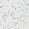 Immunohistochemistry of paraffin-embedded rat brain using H4K5AC antibody (15-941) at dilution of 1:100 (40x lens) .