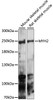 Western blot analysis of extracts of various cell lines, using MYH2 antibody (15-967) at 1:1000 dilution.<br/>Secondary antibody: HRP Goat Anti-Rabbit IgG (H+L) at 1:10000 dilution.<br/>Lysates/proteins: 25ug per lane.<br/>Blocking buffer: 3% nonfat dry milk in TBST.<br/>Detection: ECL Enhanced Kit.<br/>Exposure time: 180s.