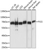 Western blot analysis of extracts of various cell lines, using PLS1 antibody (15-974) at 1:1000 dilution.<br/>Secondary antibody: HRP Goat Anti-Rabbit IgG (H+L) at 1:10000 dilution.<br/>Lysates/proteins: 25ug per lane.<br/>Blocking buffer: 3% nonfat dry milk in TBST.<br/>Detection: ECL Basic Kit.<br/>Exposure time: 3s.