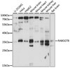 Western blot analysis of extracts of various cell lines, using RABGGTB antibody (15-982) at 1:1000 dilution.<br/>Secondary antibody: HRP Goat Anti-Rabbit IgG (H+L) at 1:10000 dilution.<br/>Lysates/proteins: 25ug per lane.<br/>Blocking buffer: 3% nonfat dry milk in TBST.<br/>Detection: ECL Basic Kit.<br/>Exposure time: 30s.