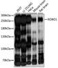 Western blot analysis of extracts of various cell lines, using ROBO1 antibody (15-984) at 1:1000 dilution.<br/>Secondary antibody: HRP Goat Anti-Rabbit IgG (H+L) at 1:10000 dilution.<br/>Lysates/proteins: 25ug per lane.<br/>Blocking buffer: 3% nonfat dry milk in TBST.<br/>Detection: ECL Basic Kit.<br/>Exposure time: 10s.
