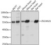 Western blot analysis of extracts of various cell lines, using ZSCAN21 antibody (15-992) at 1:1000 dilution.<br/>Secondary antibody: HRP Goat Anti-Rabbit IgG (H+L) at 1:10000 dilution.<br/>Lysates/proteins: 25ug per lane.<br/>Blocking buffer: 3% nonfat dry milk in TBST.<br/>Detection: ECL Basic Kit.<br/>Exposure time: 10s.