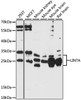 Western blot analysis of extracts of various cell lines, using LIN7A antibody (16-003) at 1:1000 dilution.<br/>Secondary antibody: HRP Goat Anti-Rabbit IgG (H+L) at 1:10000 dilution.<br/>Lysates/proteins: 25ug per lane.<br/>Blocking buffer: 3% nonfat dry milk in TBST.<br/>Detection: ECL Basic Kit.<br/>Exposure time: 60s.