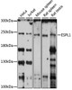 Western blot analysis of extracts of various cell lines, using ESPL1 antibody (16-015) at 1:1000 dilution.<br/>Secondary antibody: HRP Goat Anti-Rabbit IgG (H+L) at 1:10000 dilution.<br/>Lysates/proteins: 25ug per lane.<br/>Blocking buffer: 3% nonfat dry milk in TBST.<br/>Detection: ECL Enhanced Kit.<br/>Exposure time: 30s.
