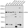 Western blot analysis of extracts of various cell lines, using KIF20A antibody (16-020) at 1:1000 dilution.<br/>Secondary antibody: HRP Goat Anti-Rabbit IgG (H+L) at 1:10000 dilution.<br/>Lysates/proteins: 25ug per lane.<br/>Blocking buffer: 3% nonfat dry milk in TBST.<br/>Detection: ECL Basic Kit.<br/>Exposure time: 15s.