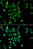 Immunofluorescence analysis of MCF-7 cells using PSMC5 antibody (16-022) . Blue: DAPI for nuclear staining.