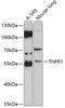Western blot analysis of extracts of various cell lines, using TNFR1 antibody (16-031) at 1:3000 dilution.<br/>Secondary antibody: HRP Goat Anti-Rabbit IgG (H+L) at 1:10000 dilution.<br/>Lysates/proteins: 25ug per lane.<br/>Blocking buffer: 3% nonfat dry milk in TBST.<br/>Detection: ECL Enhanced Kit.<br/>Exposure time: 90s.