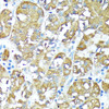 Immunohistochemistry of paraffin-embedded human stomach using TNFR1 antibody (16-031) at dilution of 1:100 (40x lens) .