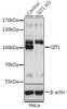 Western blot analysis of extracts from normal (control) and GIT1 knockout (KO) HeLa cells, using GIT1 antibody (16-047) at 1:3000 dilution.<br/>Secondary antibody: HRP Goat Anti-Rabbit IgG (H+L) at 1:10000 dilution.<br/>Lysates/proteins: 25ug per lane.<br/>Blocking buffer: 3% nonfat dry milk in TBST.<br/>Detection: ECL Basic Kit.<br/>Exposure time: 1s.