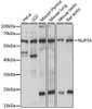 Western blot analysis of extracts of various cell lines, using NUP54 antibody (16-053) at 1:1000 dilution.<br/>Secondary antibody: HRP Goat Anti-Rabbit IgG (H+L) at 1:10000 dilution.<br/>Lysates/proteins: 25ug per lane.<br/>Blocking buffer: 3% nonfat dry milk in TBST.<br/>Detection: ECL Basic Kit.<br/>Exposure time: 10s.