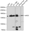 Western blot analysis of extracts of various cell lines, using eNOS antibody (16-064) at 1:1000 dilution.<br/>Secondary antibody: HRP Goat Anti-Rabbit IgG (H+L) at 1:10000 dilution.<br/>Lysates/proteins: 25ug per lane.<br/>Blocking buffer: 3% nonfat dry milk in TBST.<br/>Detection: ECL Basic Kit.<br/>Exposure time: 30s.