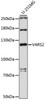 Western blot analysis of extracts of U-251MG cells, using VARS2 antibody (16-066) at 1:1000 dilution.<br/>Secondary antibody: HRP Goat Anti-Rabbit IgG (H+L) at 1:10000 dilution.<br/>Lysates/proteins: 25ug per lane.<br/>Blocking buffer: 3% nonfat dry milk in TBST.<br/>Detection: ECL Basic Kit.<br/>Exposure time: 90s.