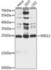 Western blot analysis of extracts of various cell lines, using MIS12 antibody (16-082) at 1:1000 dilution.<br/>Secondary antibody: HRP Goat Anti-Rabbit IgG (H+L) at 1:10000 dilution.<br/>Lysates/proteins: 25ug per lane.<br/>Blocking buffer: 3% nonfat dry milk in TBST.<br/>Detection: ECL Basic Kit.<br/>Exposure time: 30s.