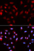 Immunofluorescence analysis of U2OS cells using Survivin antibody (16-083) . Blue: DAPI for nuclear staining.